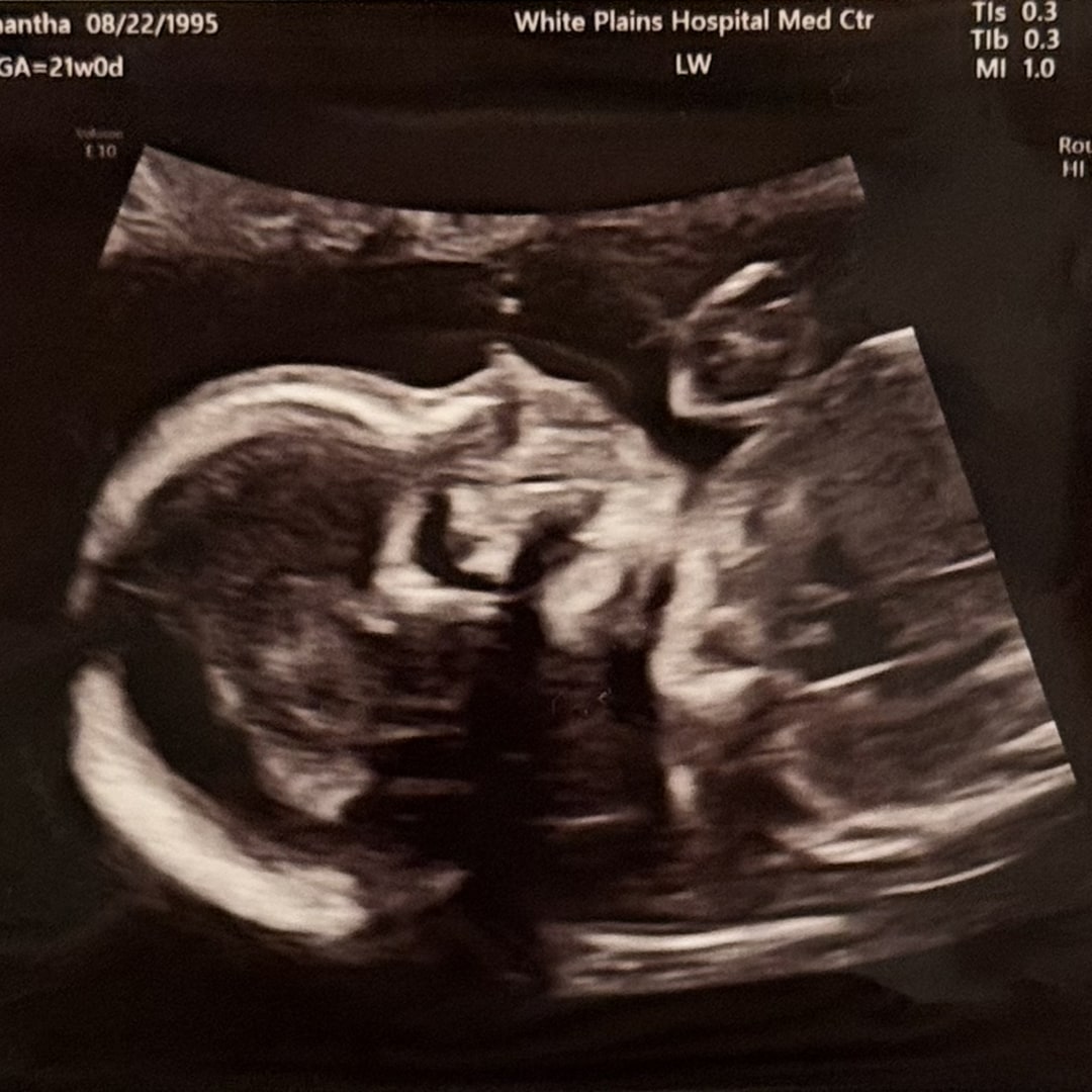 Photo shared by Samantha for their Babylist baby registry.