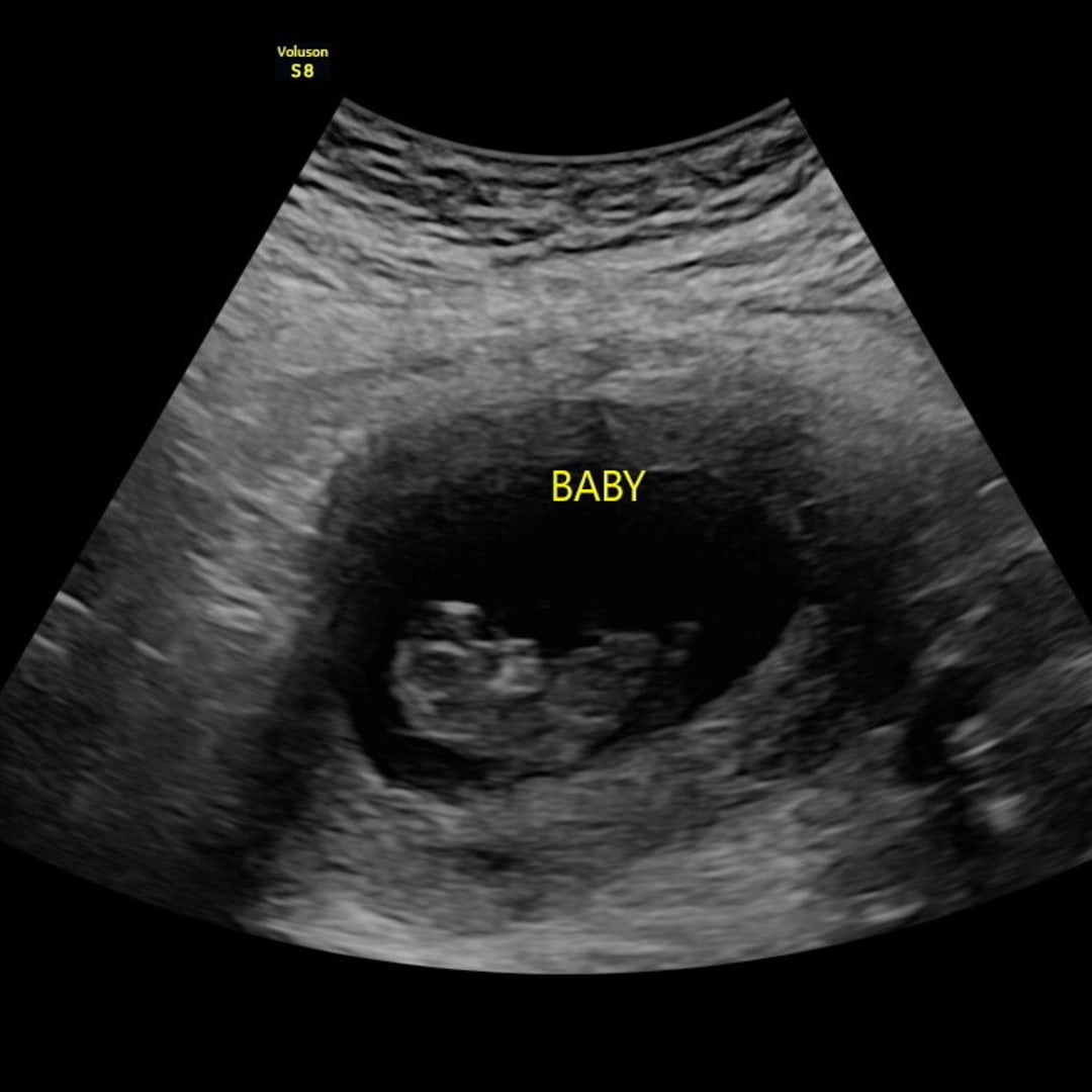 Photo shared by Jessica for their Babylist baby registry.