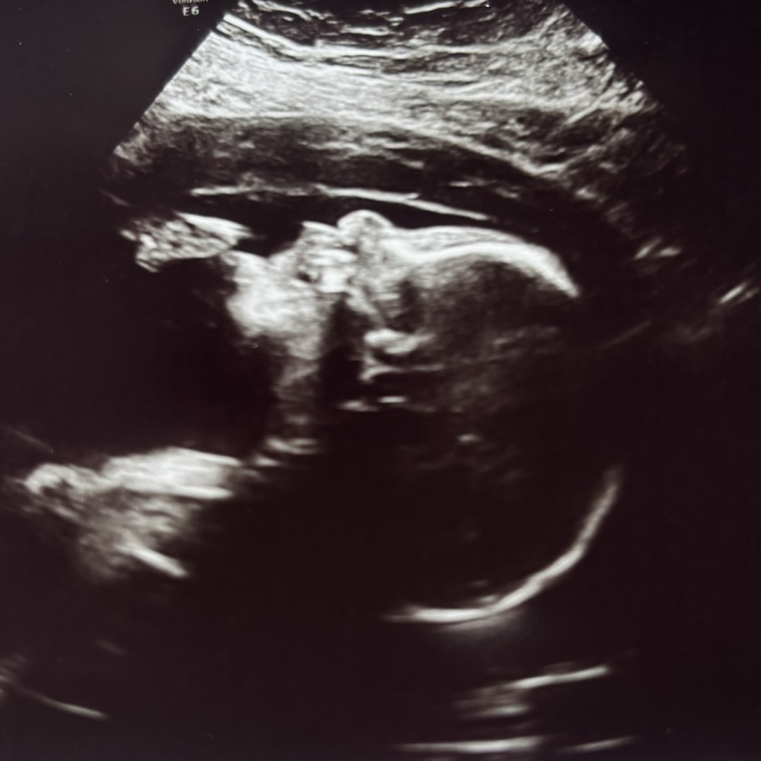 Photo shared by Keana for their Babylist baby registry.