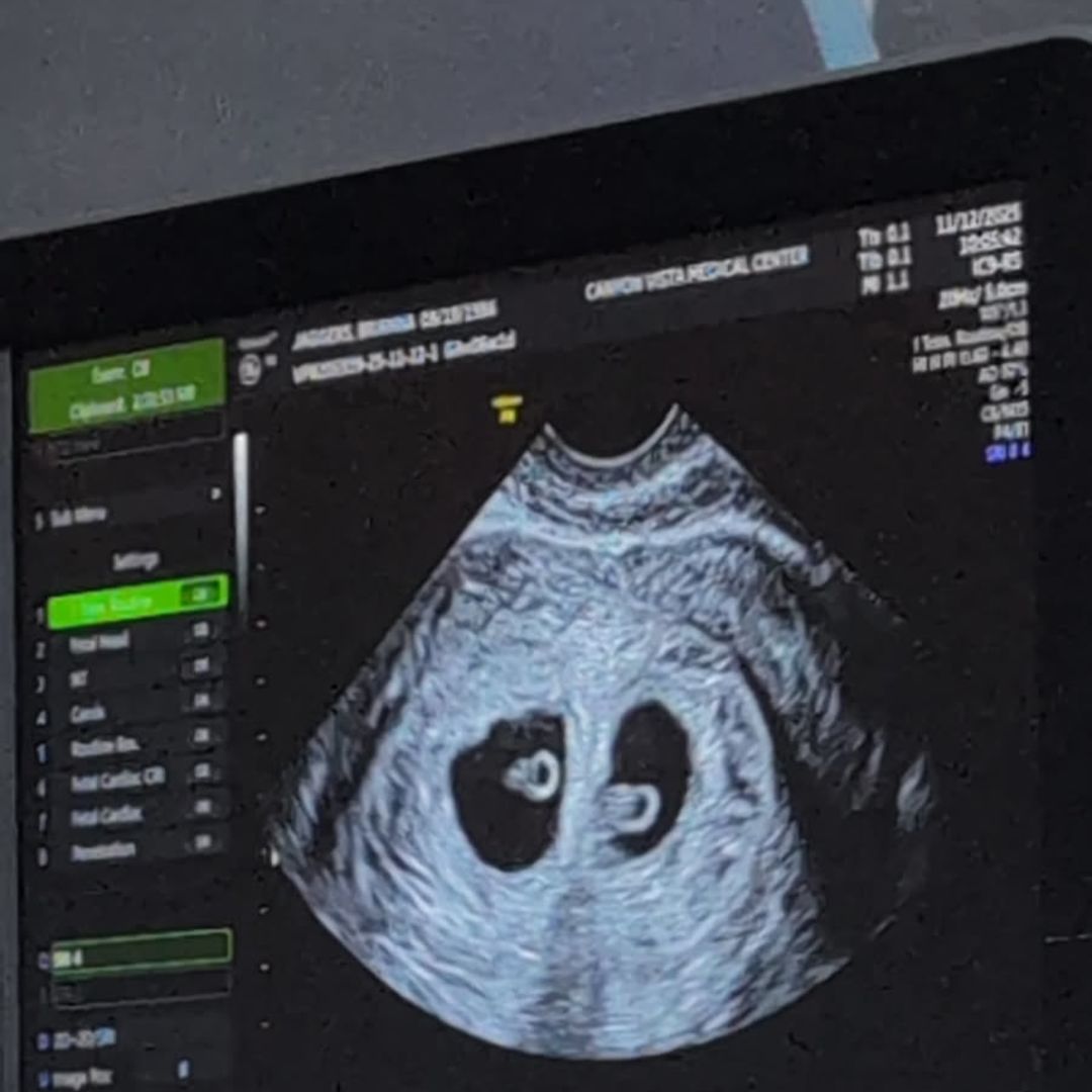 Photo shared by Brianna for their Babylist baby registry.