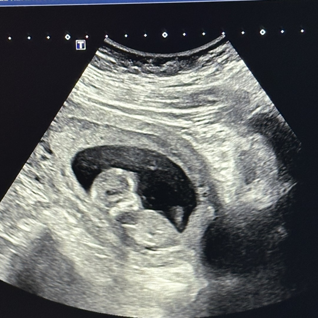 Photo shared by Ashley for their Babylist baby registry.