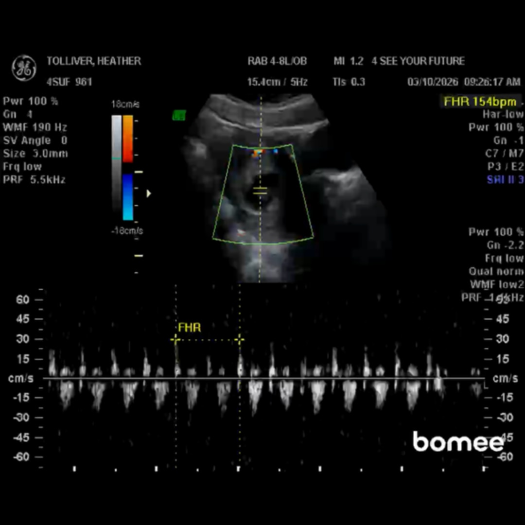 Photo shared by Heather for their Babylist baby registry.