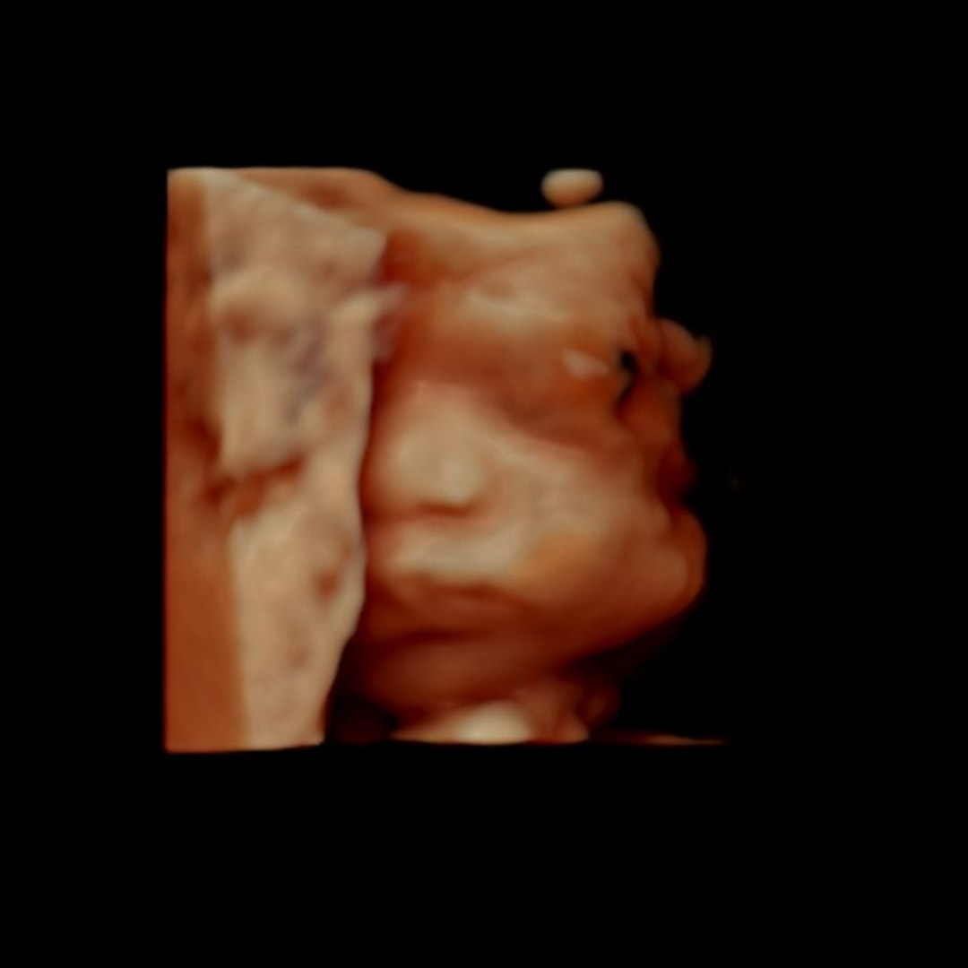 Photo shared by Leah for their Babylist baby registry.