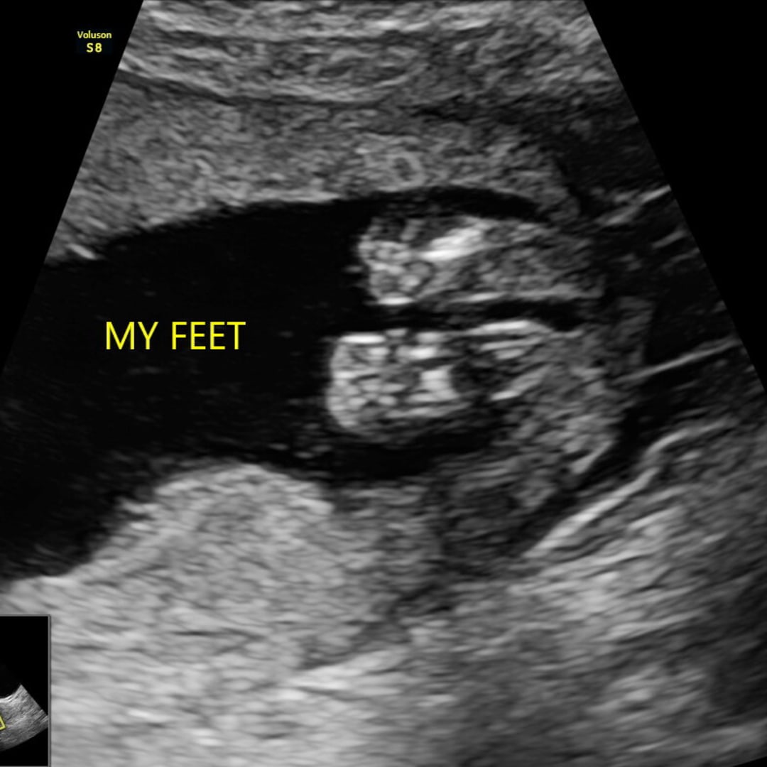 Photo shared by Kylie for their Babylist baby registry.