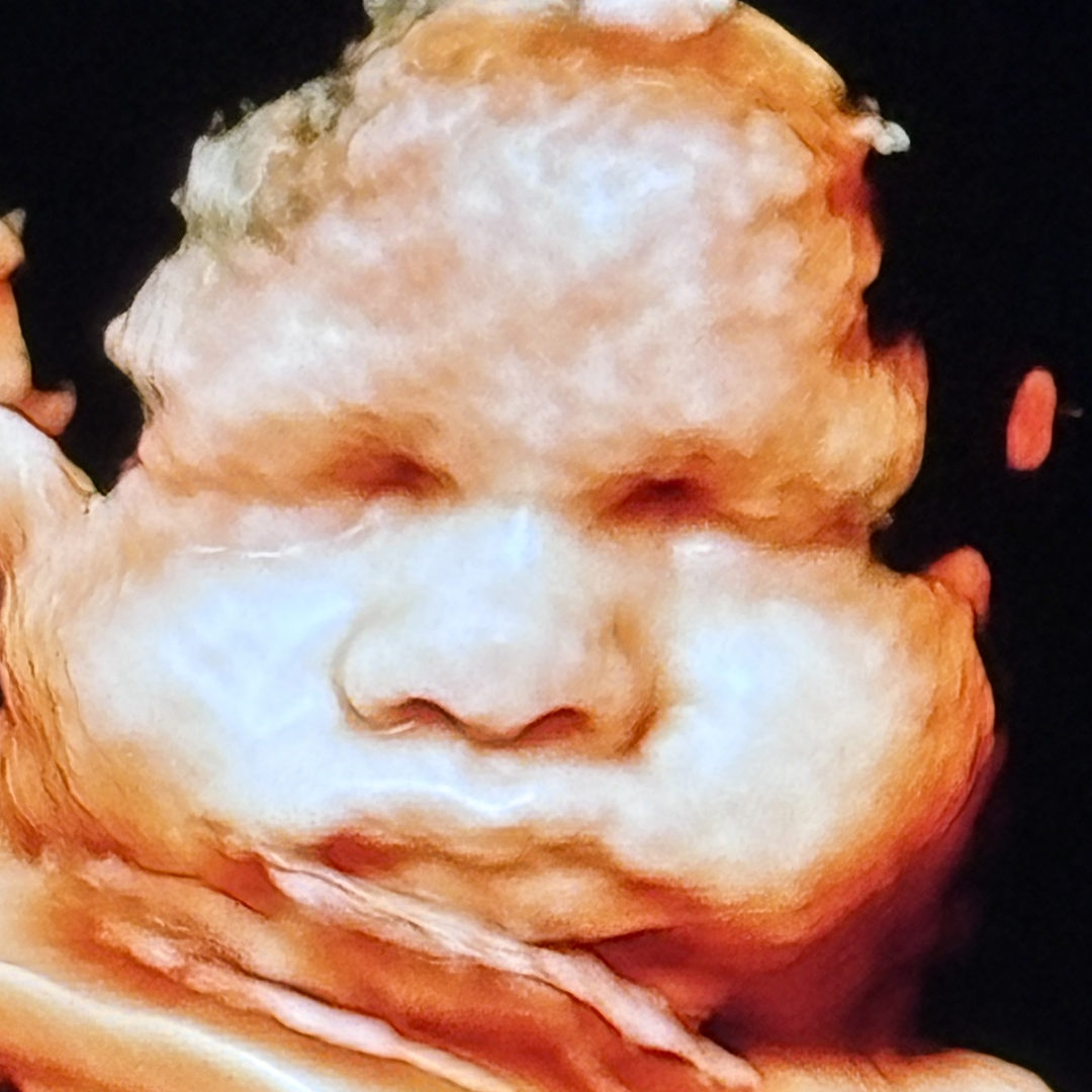 Photo shared by Ivee for their Babylist baby registry.