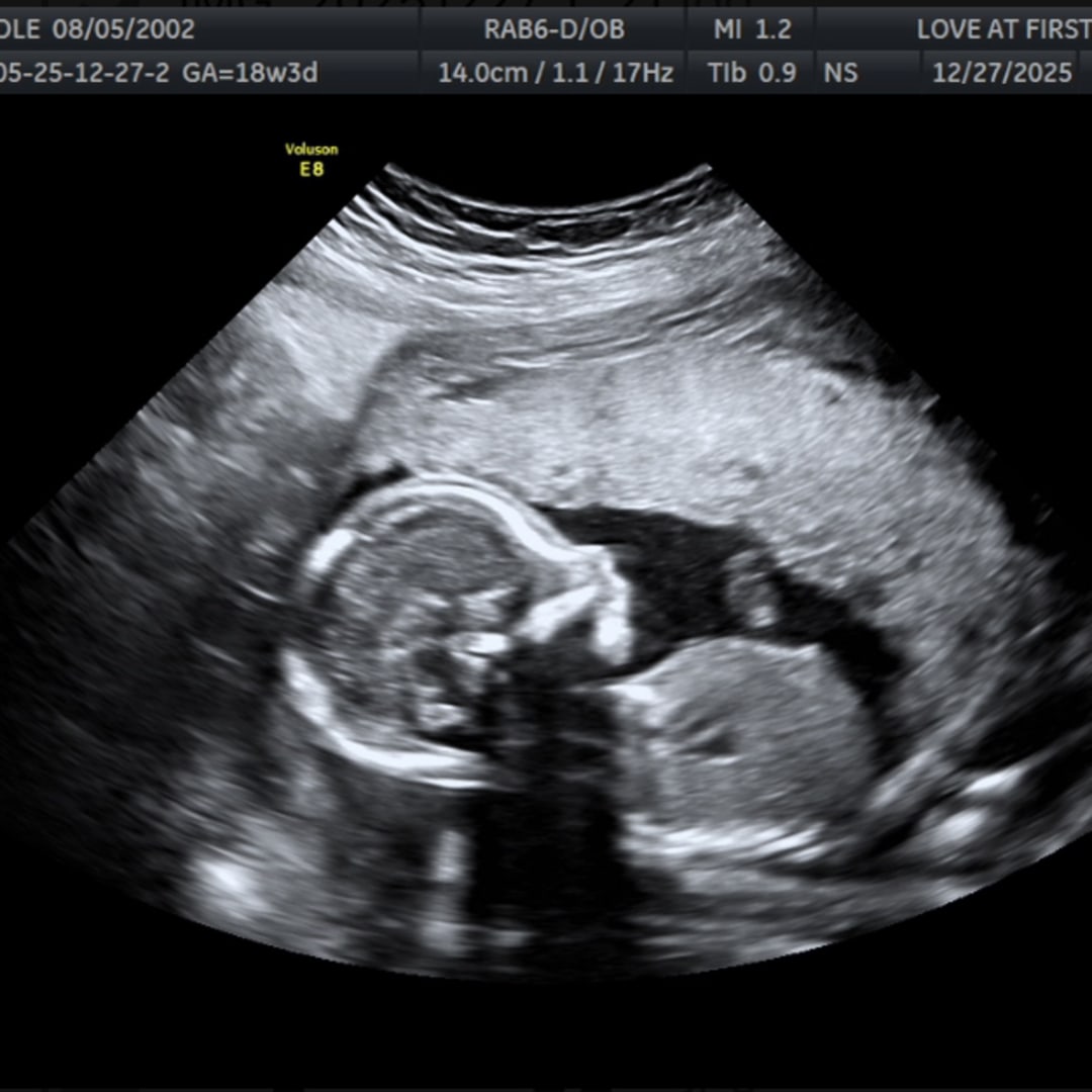 Photo shared by Chloe for their Babylist baby registry.