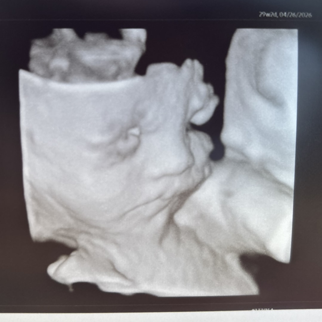 Photo shared by Aleyah for their Babylist baby registry.