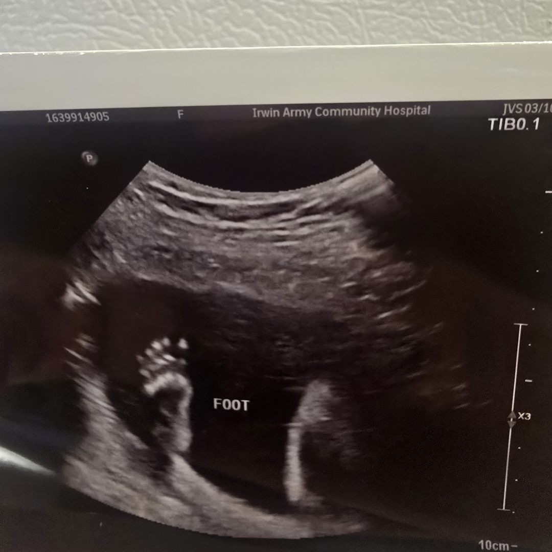 Photo shared by Joy for their Babylist baby registry.