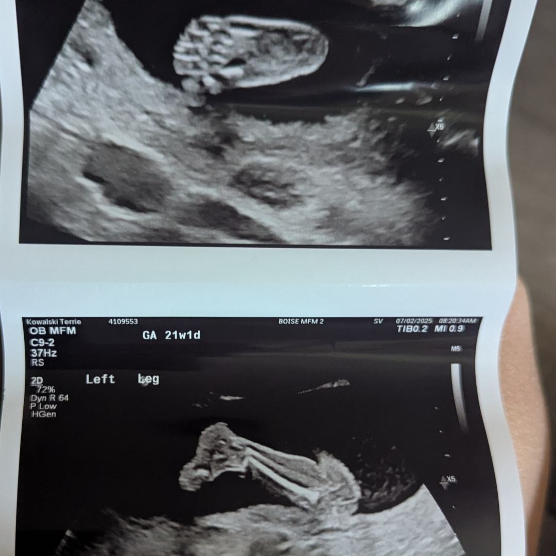 Photo shared by Terrie for their Babylist baby registry.