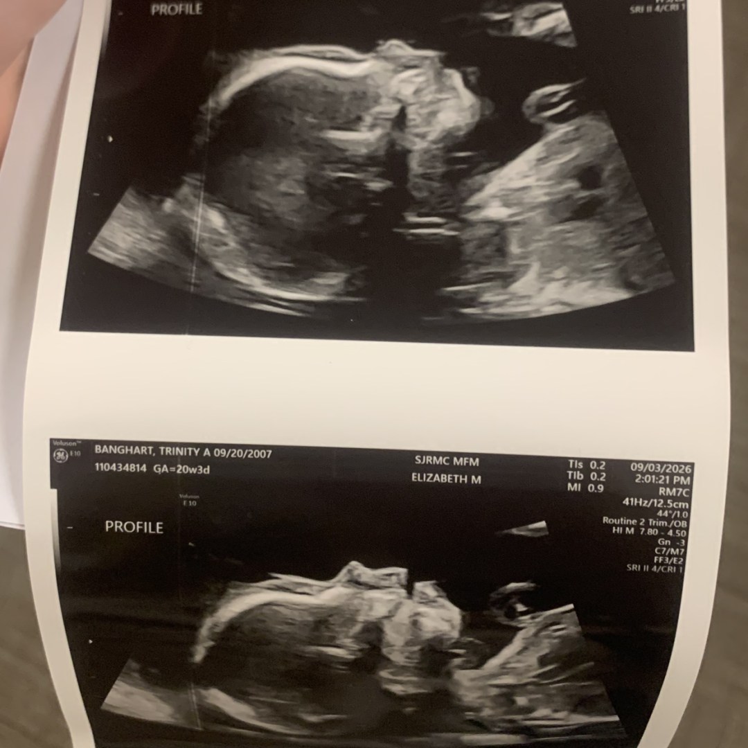 Photo shared by Trinity for their Babylist baby registry.