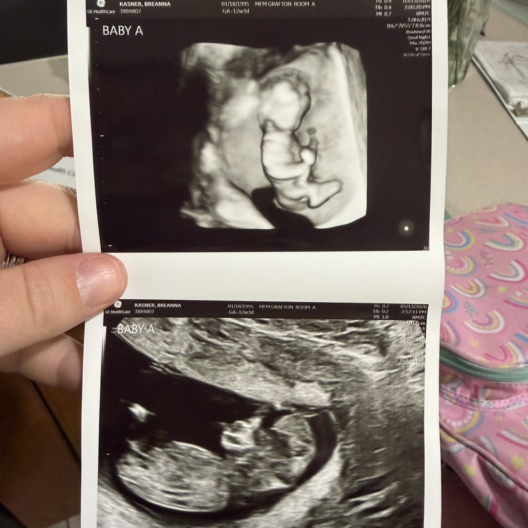 Photo shared by Breanna for their Babylist baby registry.