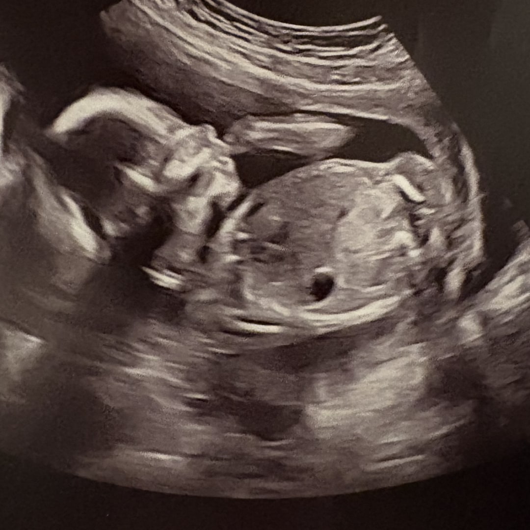 Photo shared by Becca for their Babylist baby registry.