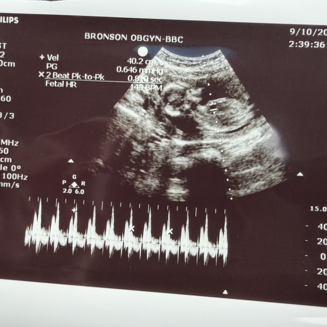 Photo shared by Hannah for their Babylist baby registry.