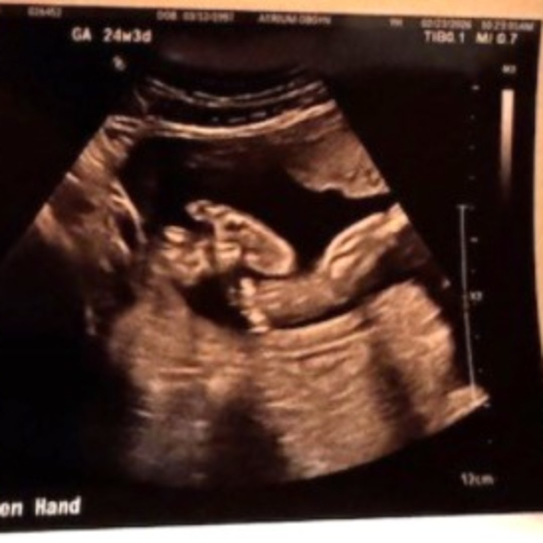 Photo shared by Hannah for their Babylist baby registry.