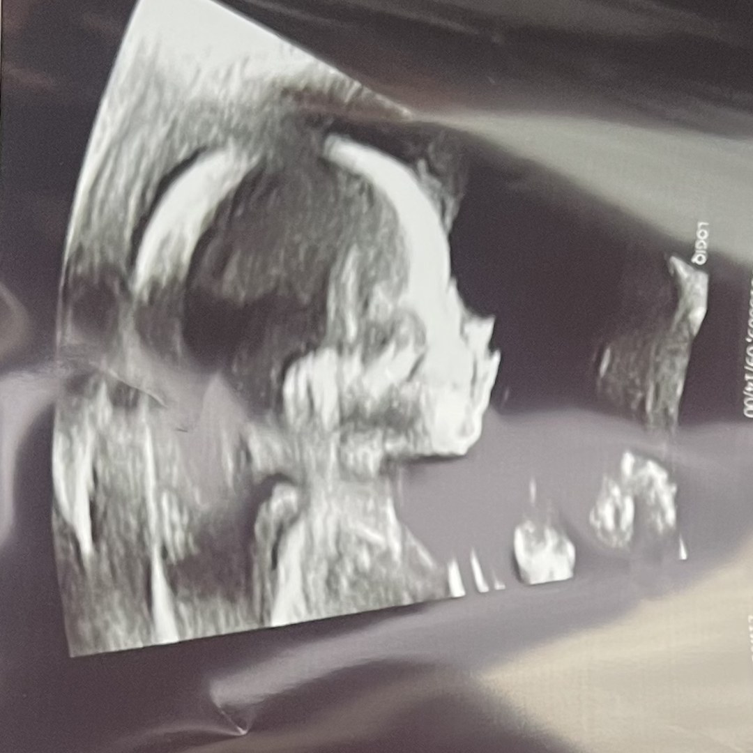 Photo shared by Shelby for their Babylist baby registry.