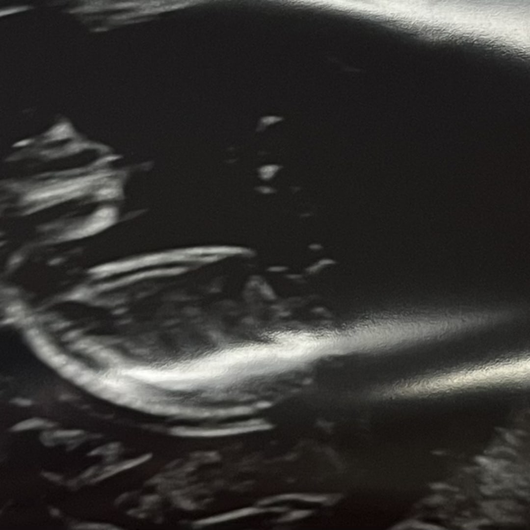 Photo shared by Ashley for their Babylist baby registry.