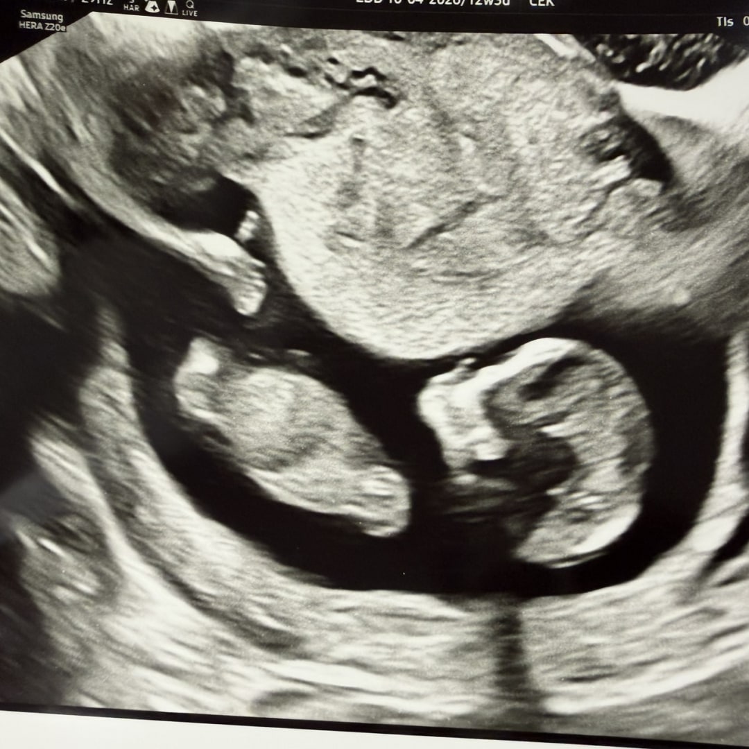 Photo shared by Megan for their Babylist baby registry.