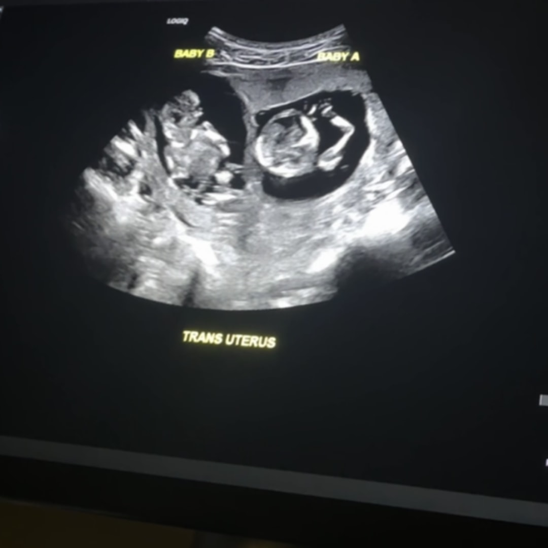 Photo shared by Renee for their Babylist baby registry.