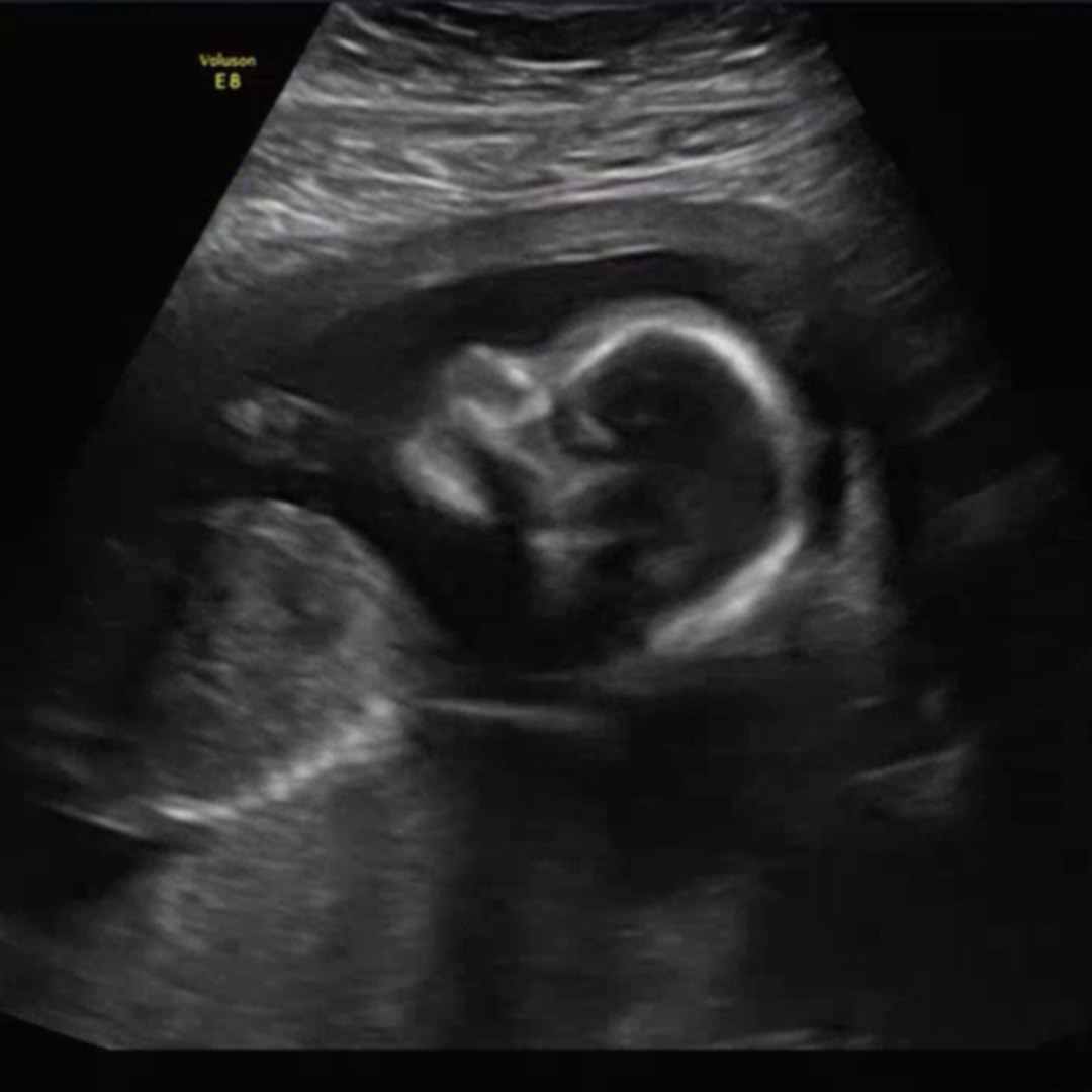 Photo shared by Vanessa for their Babylist baby registry.