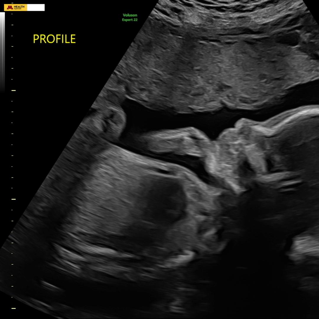 Photo shared by Jenna for their Babylist baby registry.