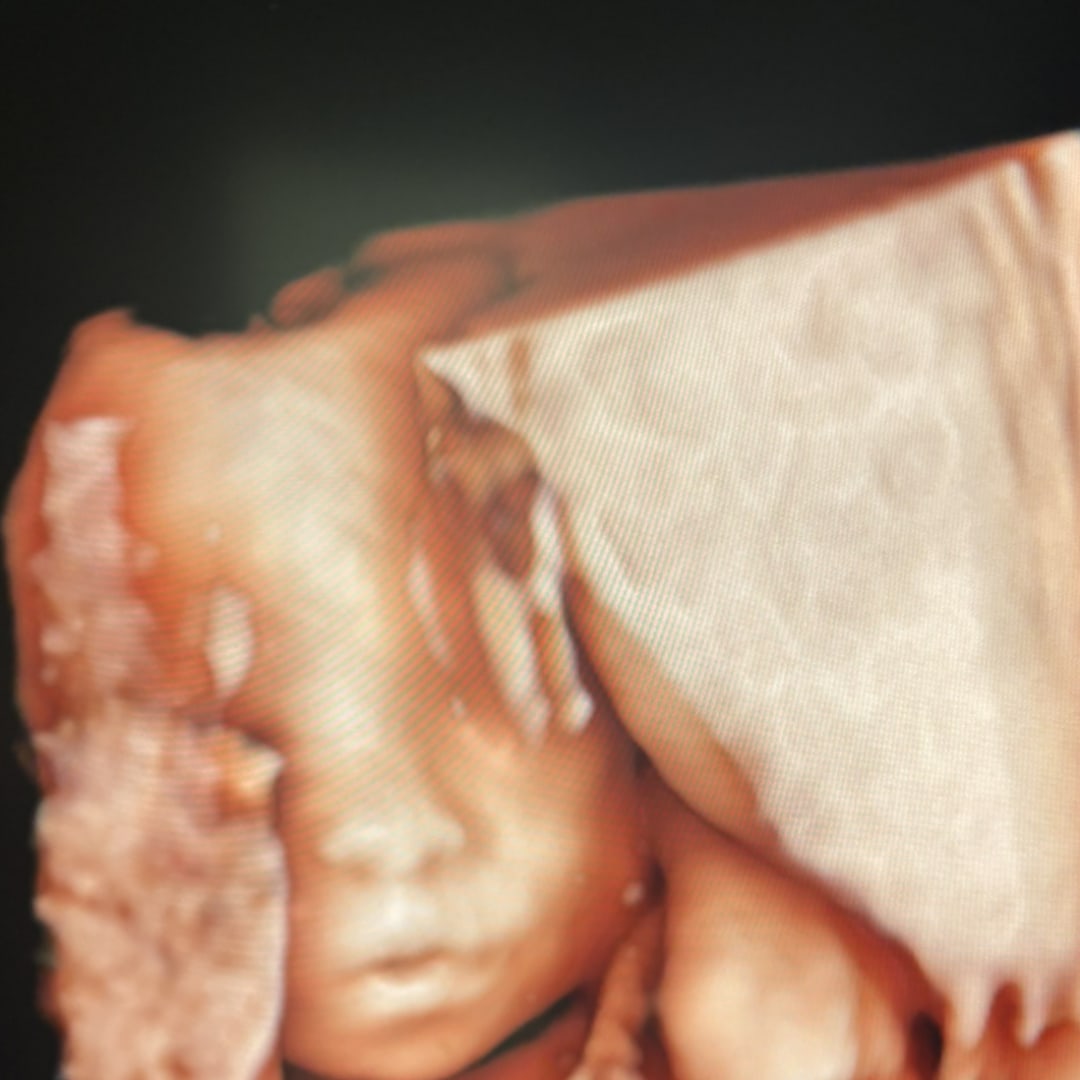 Photo shared by Kheyjmie for their Babylist baby registry.