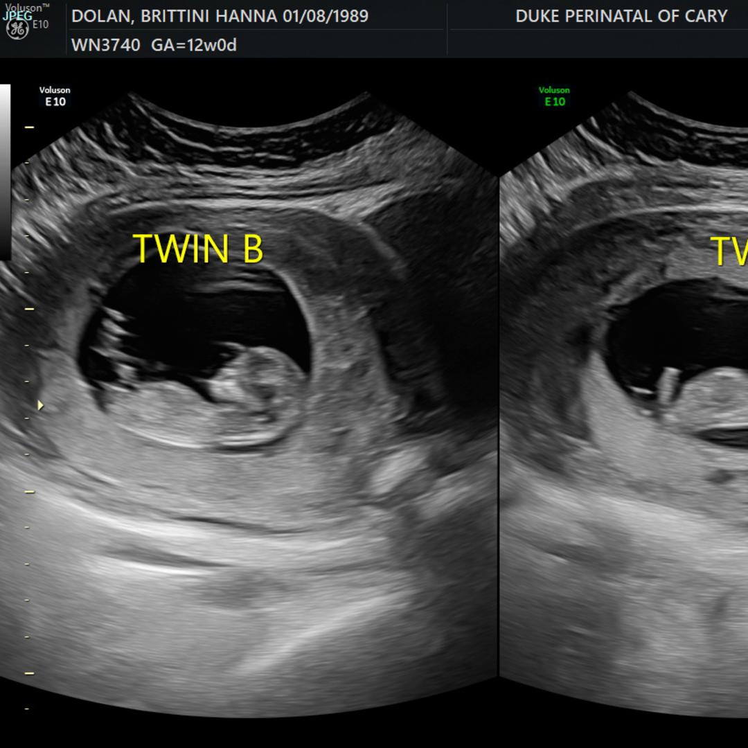 Photo shared by Brittini for their Babylist baby registry.