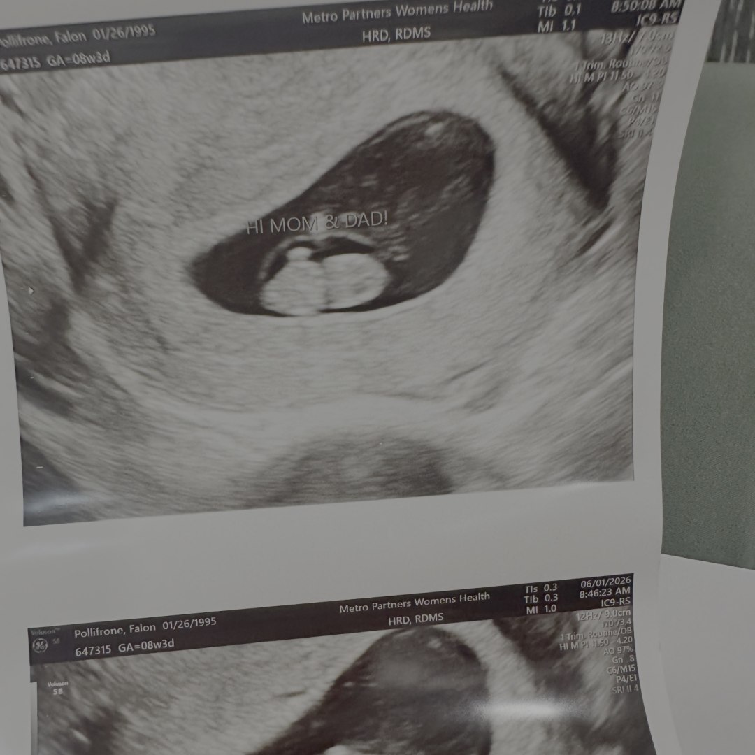 Photo shared by Falon for their Babylist baby registry.