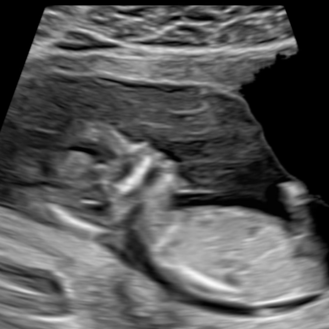 Photo shared by Isis for their Babylist baby registry.
