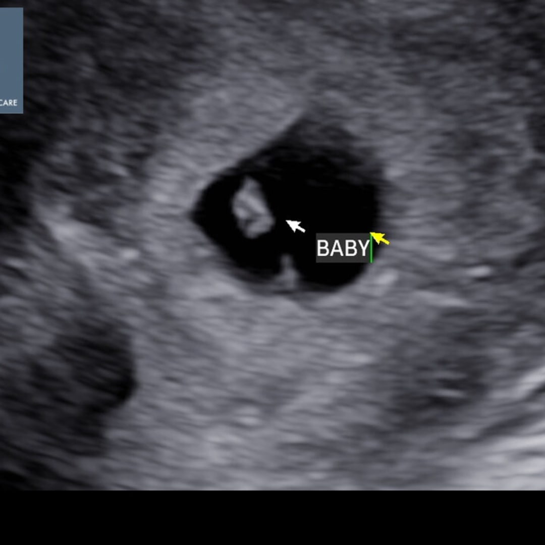 Photo shared by Samantha for their Babylist baby registry.