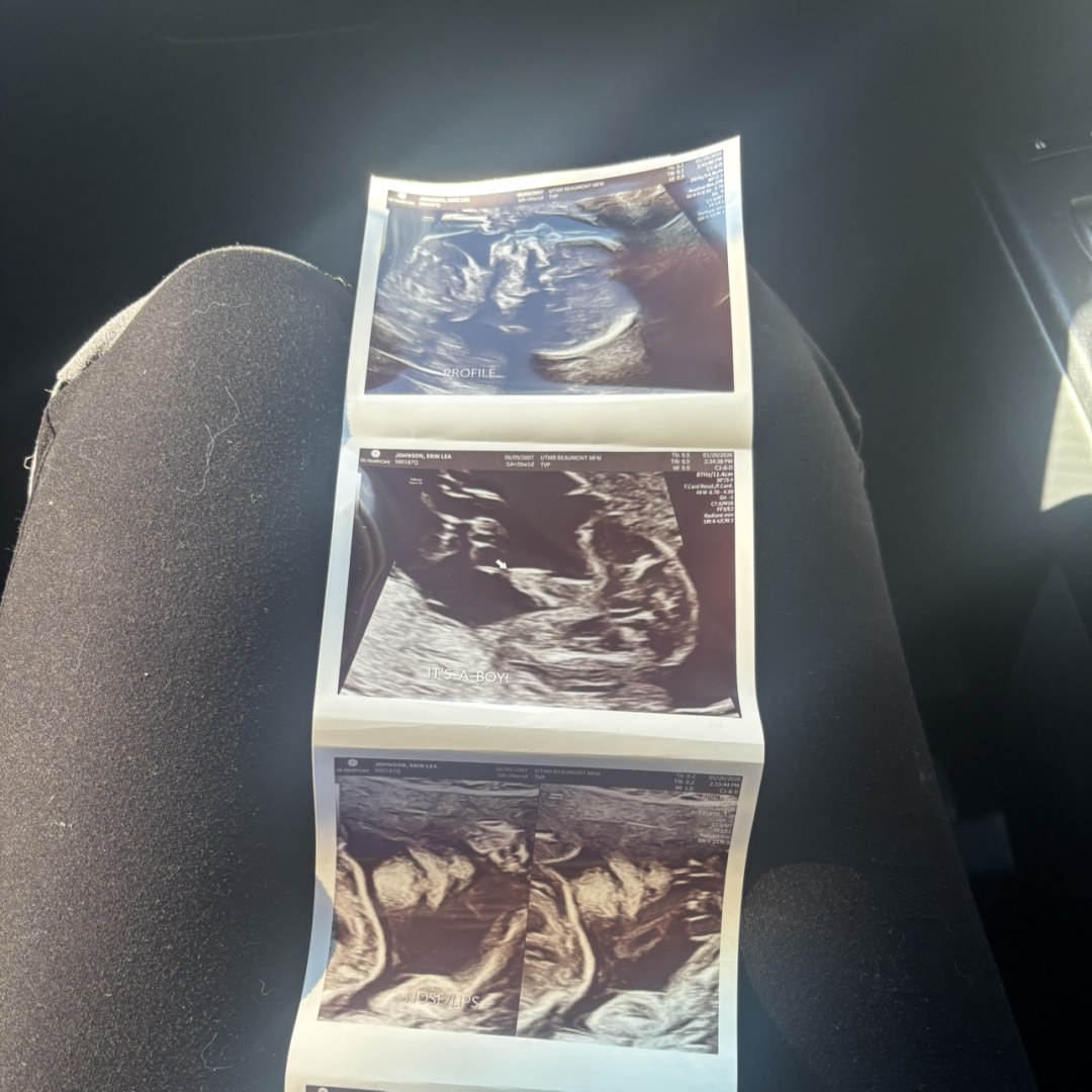 Photo shared by Erin for their Babylist baby registry.