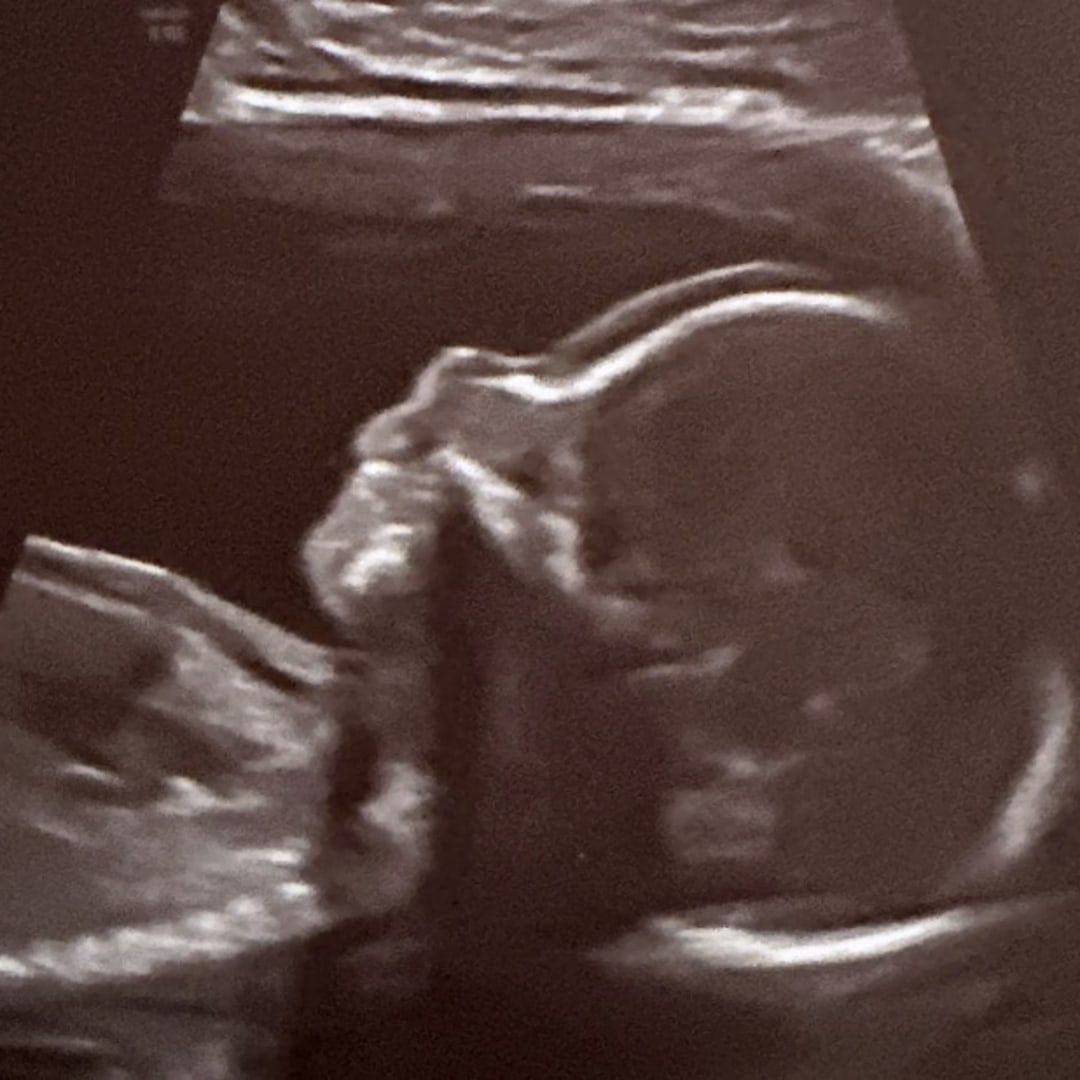 Photo shared by Brianne for their Babylist baby registry.