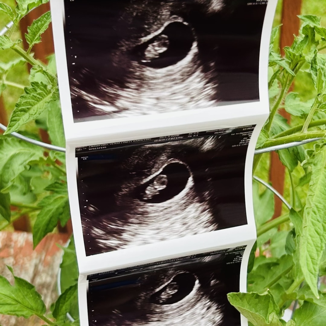 Photo shared by Olivia for their Babylist baby registry.