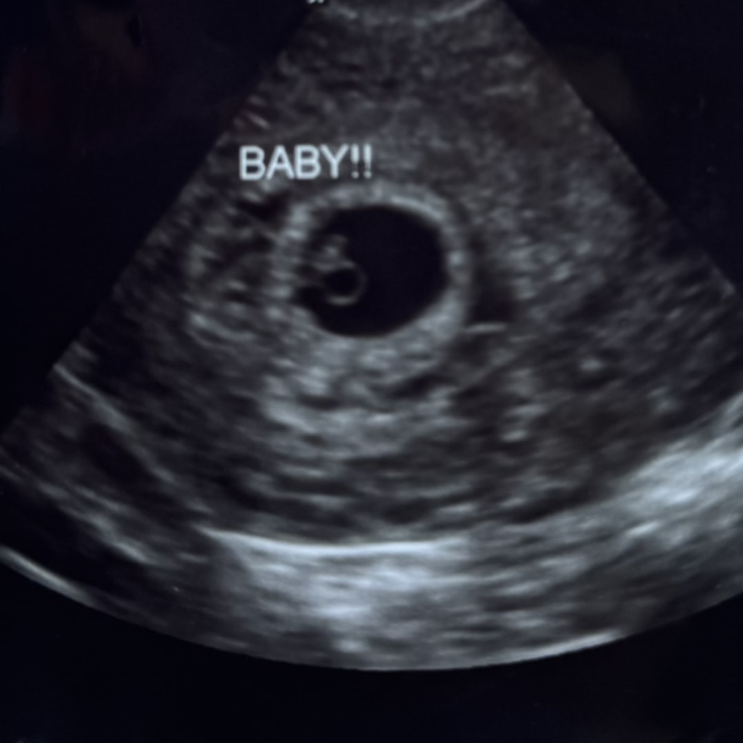 Photo shared by Jasmine for their Babylist baby registry.
