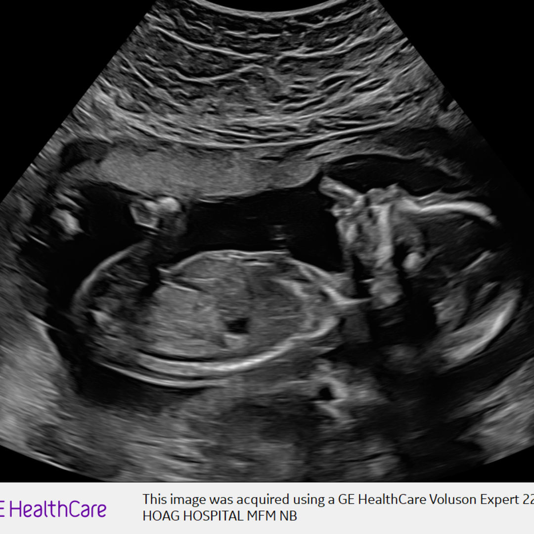 Photo shared by Courtney for their Babylist baby registry.