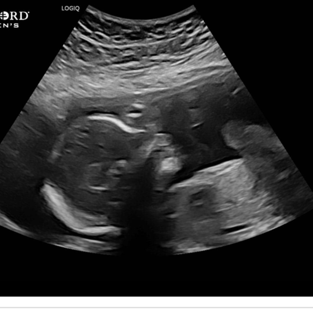 Photo shared by Maddi for their Babylist baby registry.