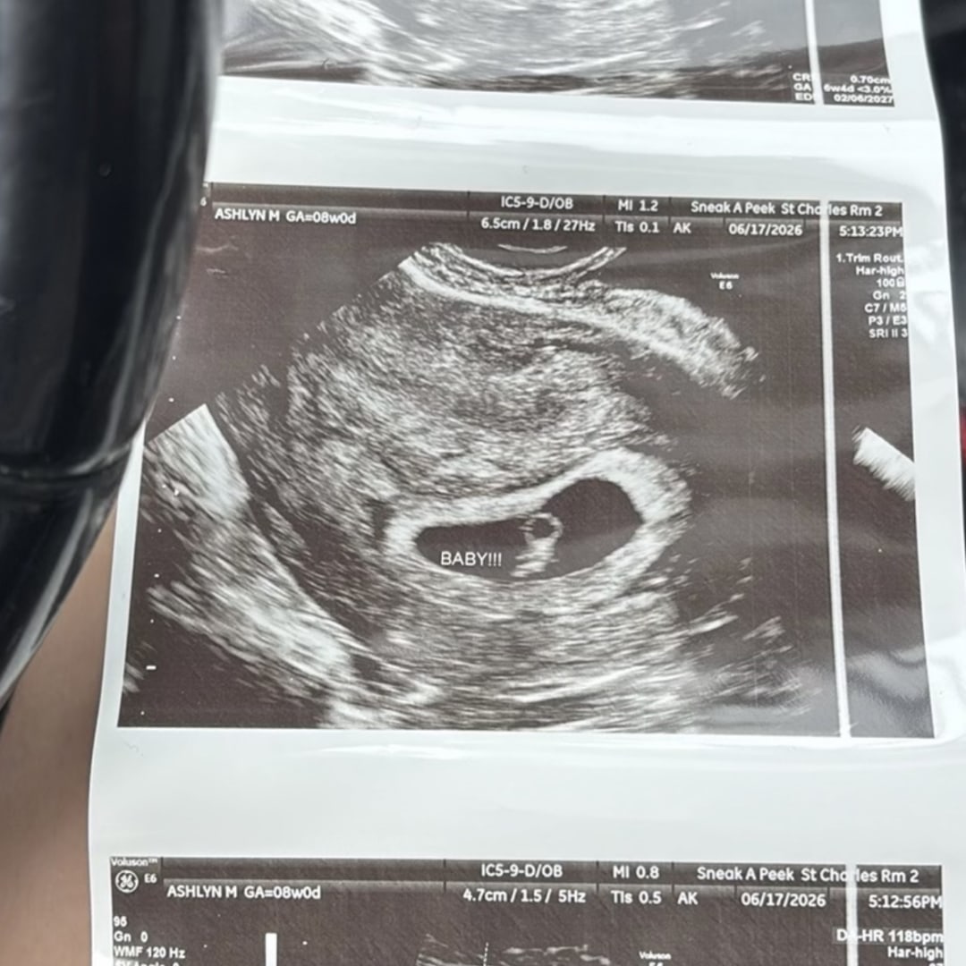 Photo shared by Ashlyn for their Babylist baby registry.