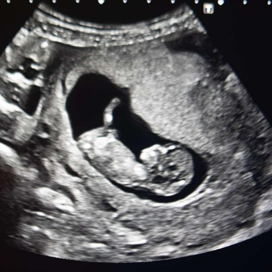Photo shared by Emma for their Babylist baby registry.