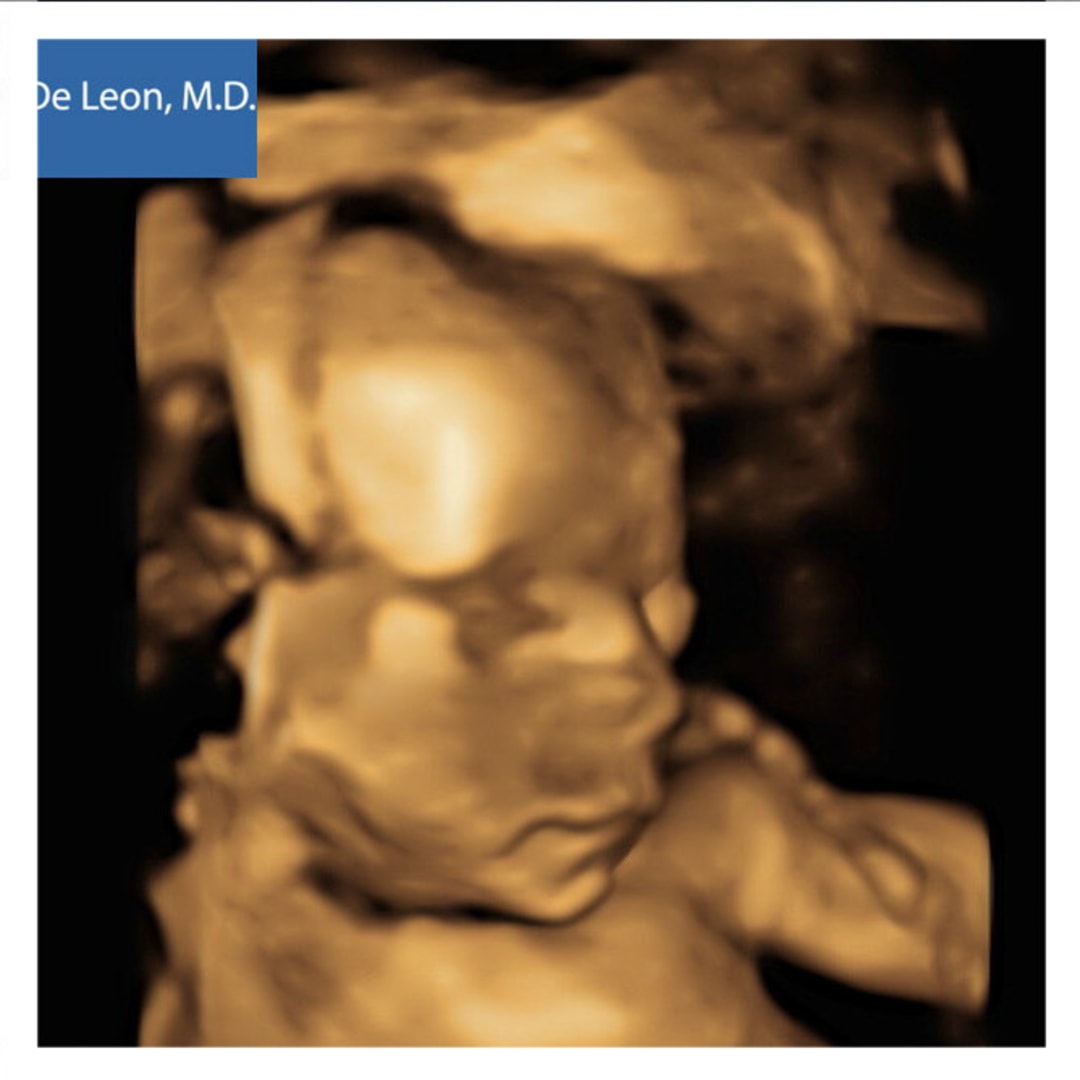 Photo shared by Jeimarys for their Babylist baby registry.