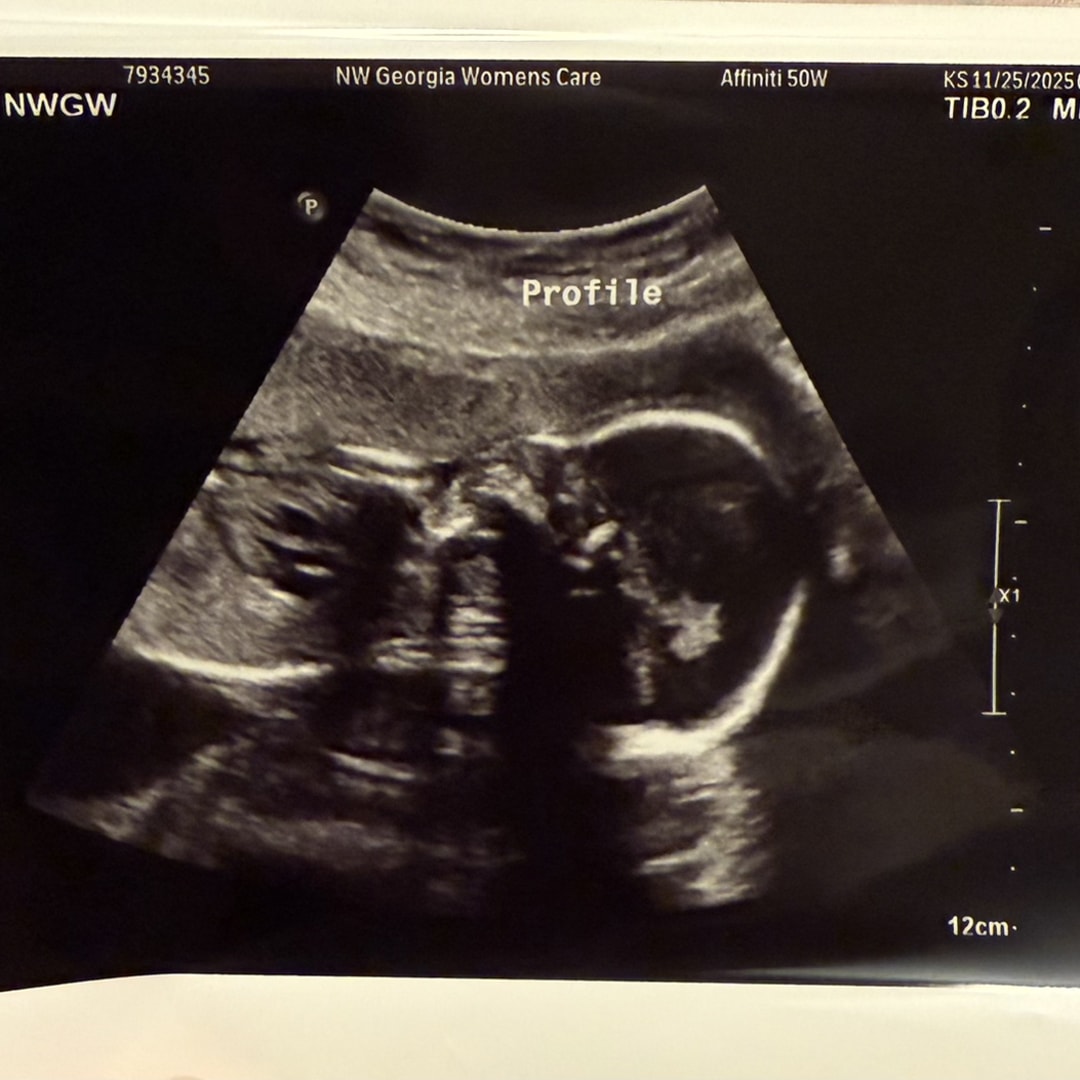 Photo shared by Kelly for their Babylist baby registry.