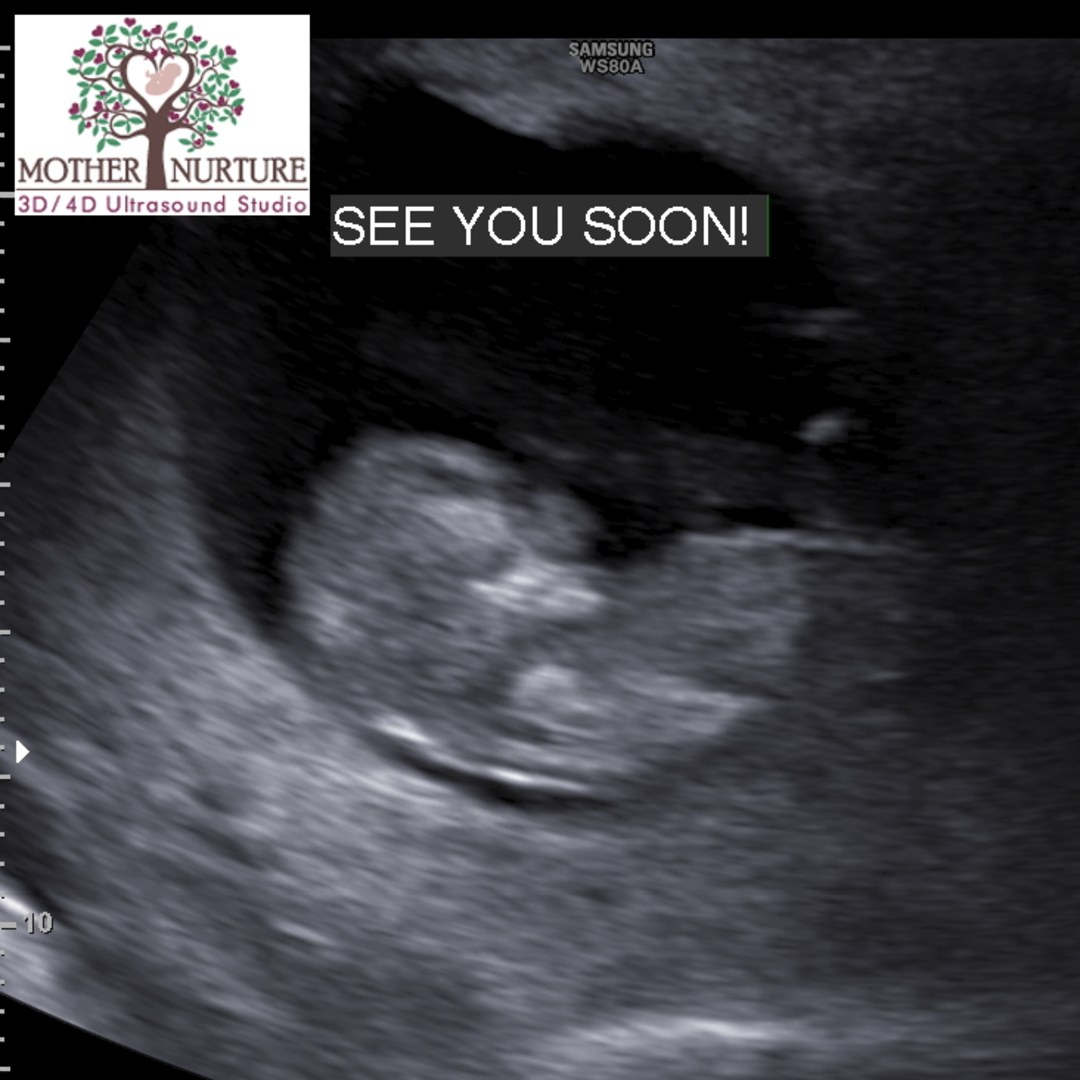 Photo shared by Cheryl for their Babylist baby registry.
