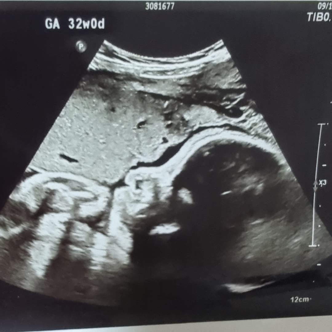 Photo shared by Katie for their Babylist baby registry.