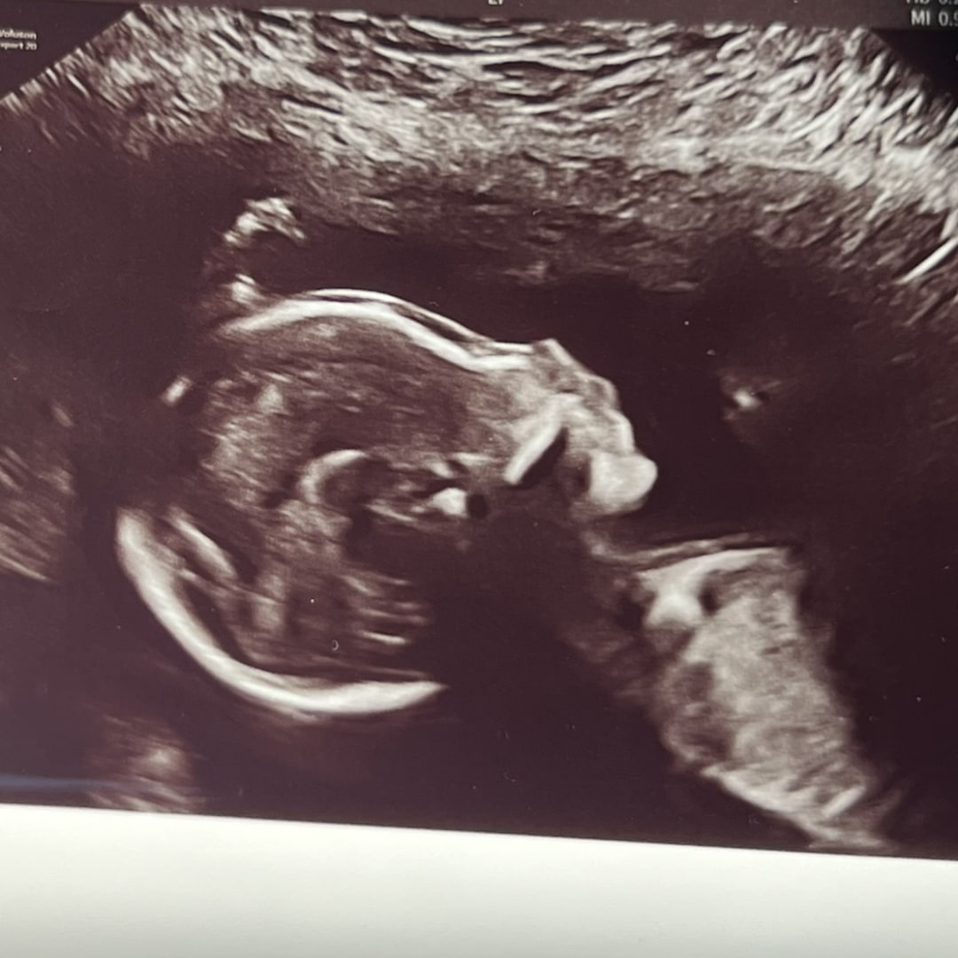 Photo shared by Jaidan for their Babylist baby registry.