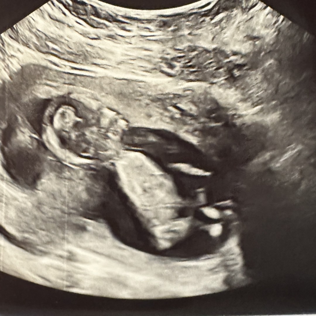 Photo shared by Chardonnay for their Babylist baby registry.