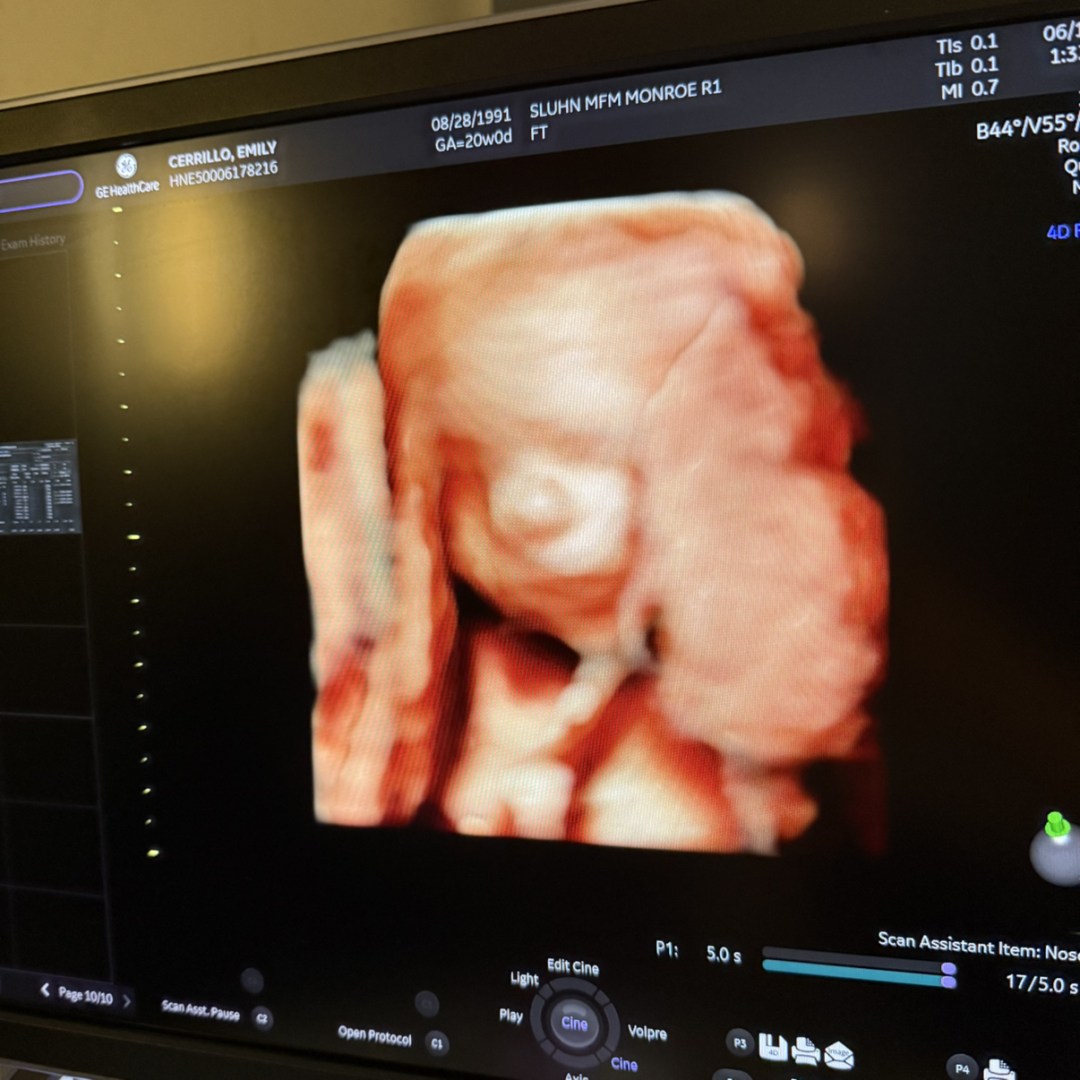 Photo shared by Emily for their Babylist baby registry.