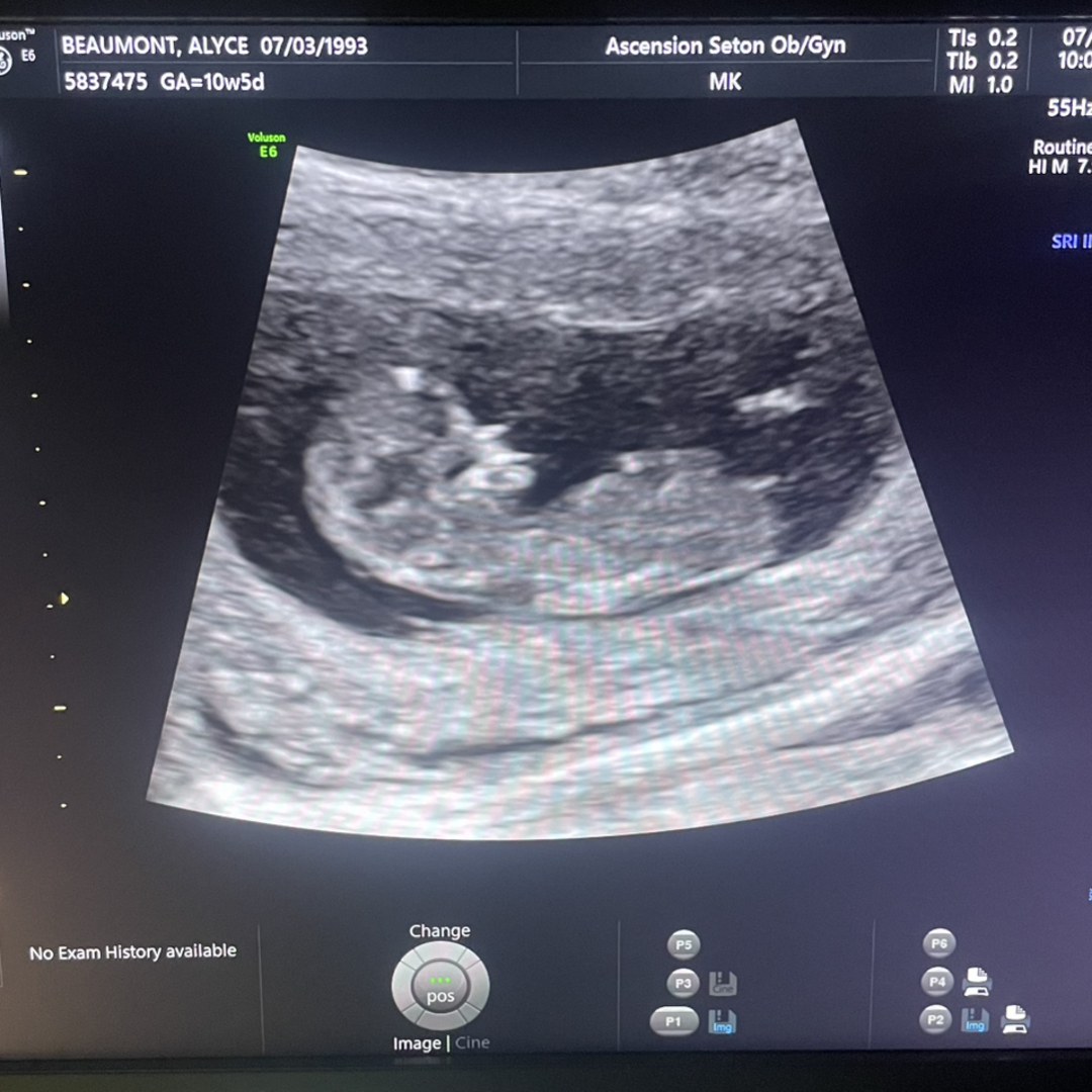 Photo shared by Alyce for their Babylist baby registry.