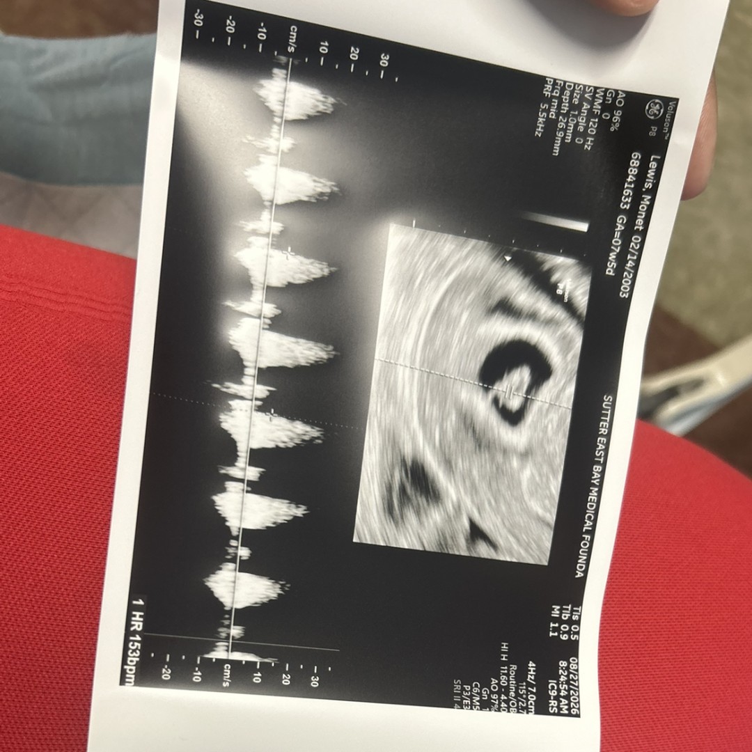 Photo shared by Valentina for their Babylist baby registry.