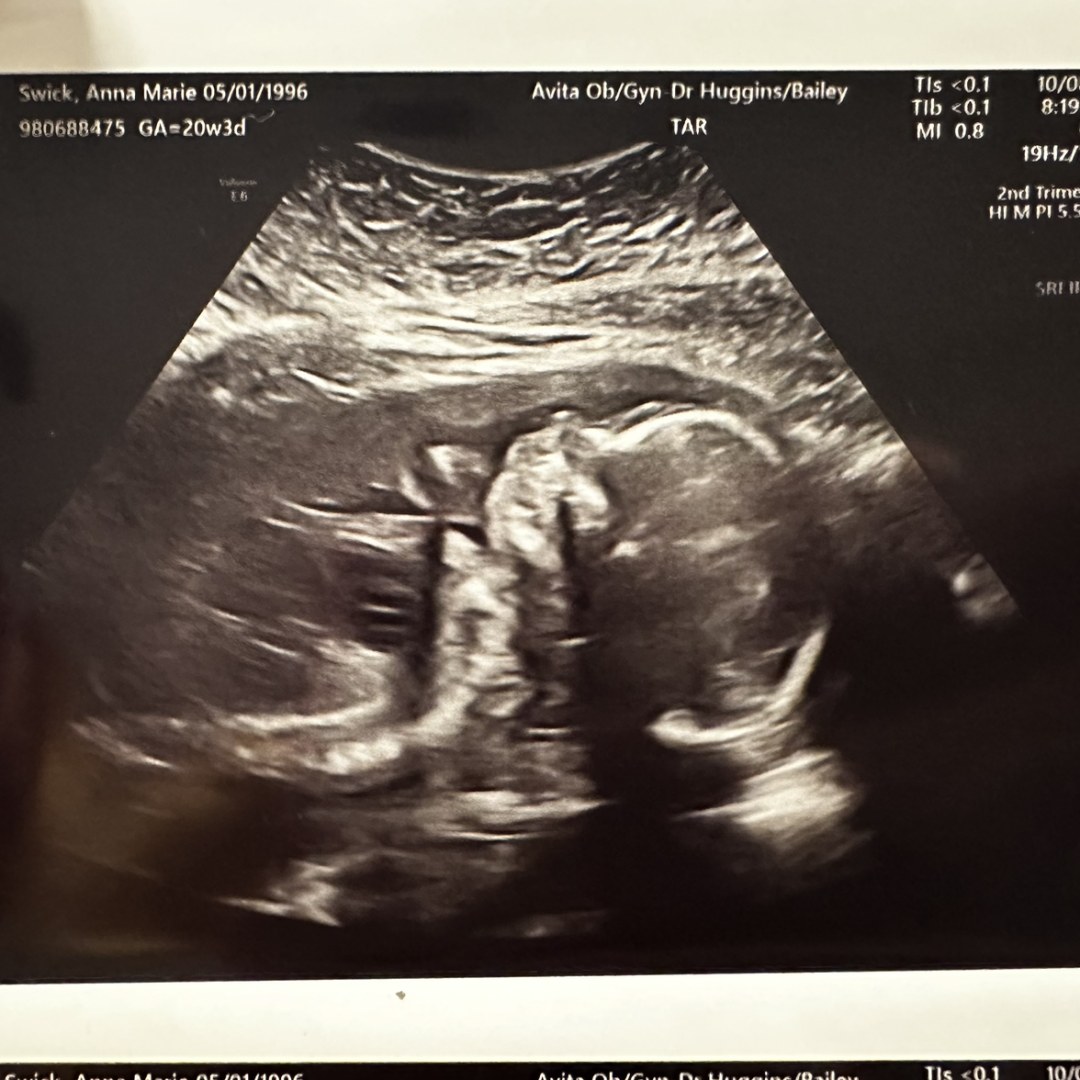 Photo shared by Anna for their Babylist baby registry.