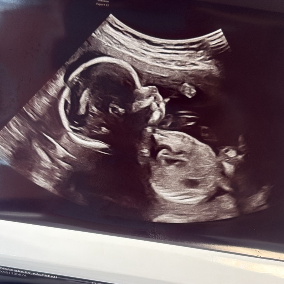 Photo shared by Khamari for their Babylist baby registry.