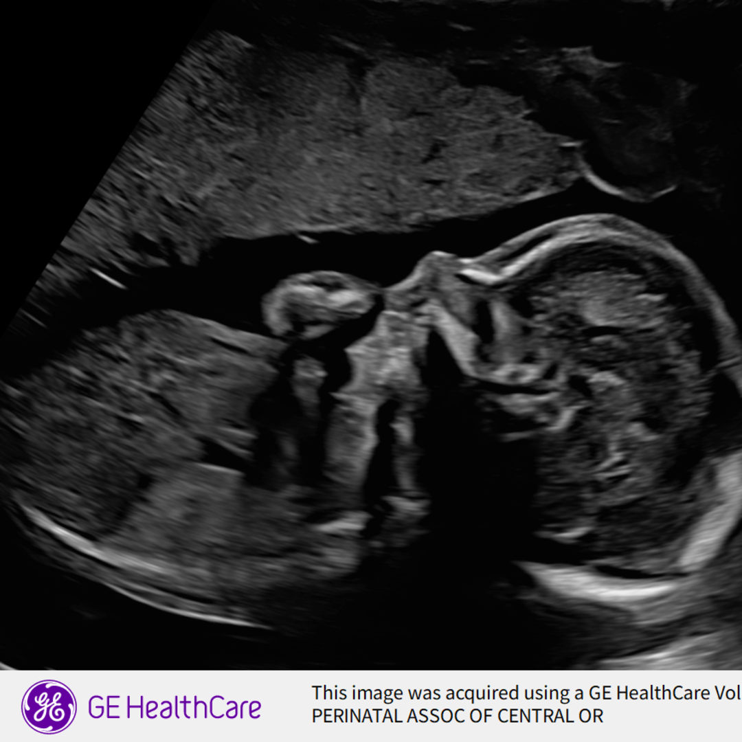 Photo shared by Amy for their Babylist baby registry.