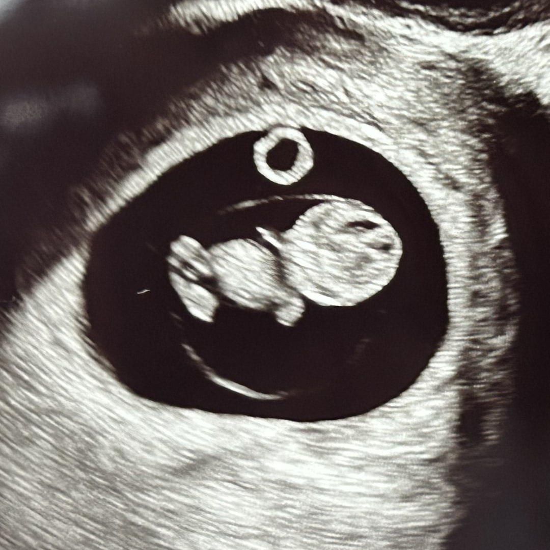 Photo shared by Angela for their Babylist baby registry.